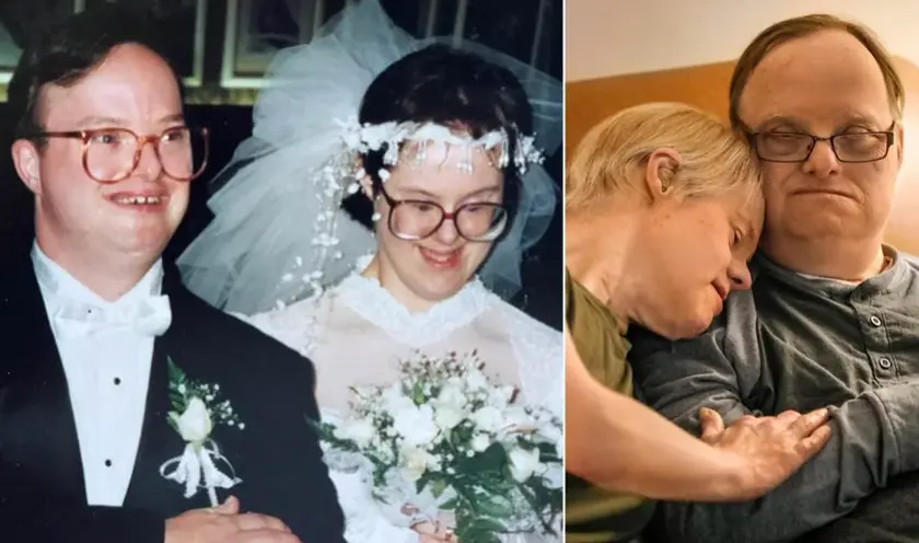 Kris and Paul Scharoun-DeForge, Couple with Down Syndrome Who Made History with 25-Year Marriage.