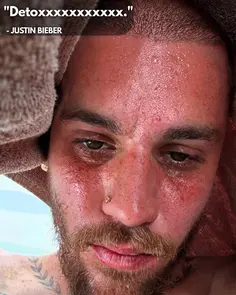 Justin Bieber is sweating in his latest Instagram post... I hope he gets the help he needs. 🙏
