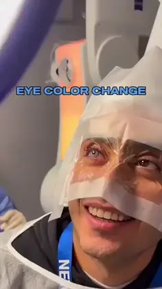 Got Surgery To Change My Eye Color!