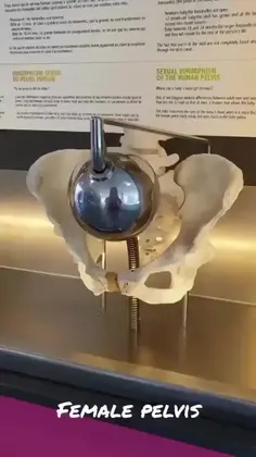 Male Pelvis vs Female Pelvis